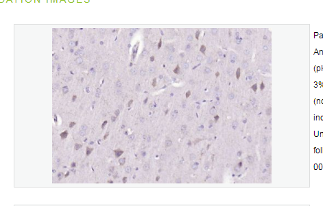 Anti-RNA polymerase IIantibody   -RNA聚合酶II抗体