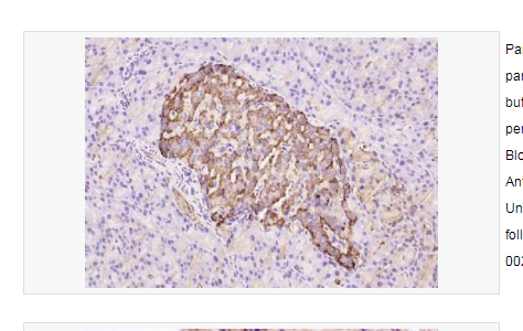 Anti-TIMP-1 antibody   -金属蛋白酶组织抑制因子-1抗体