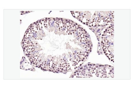 Anti-RNA polymerase IIantibody   -RNA聚合酶II抗体