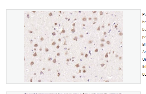 Anti-HRG1 antibody  -神经调节蛋白1β2抗体