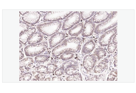 Anti-FBXO2 antibody  -F-box蛋白2抗体