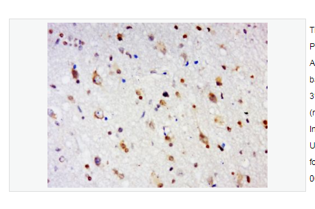 Anti-GPR84 antibody  -G蛋白偶联受体84抗体