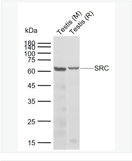 Anti-SRC antibody  -Src原癌基因抗体