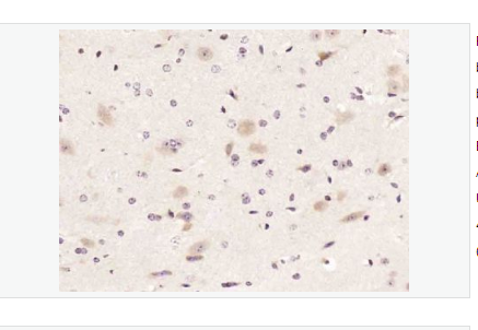 Anti-FAR2 antibody  -脂肪酰辅酶A还原酶2抗体