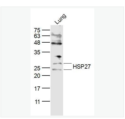 Anti-HSP27  antibody  -热休克蛋白27抗体