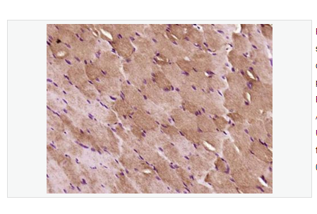 Anti-IRS-2  antibody  -胰岛素受体底物-2抗体