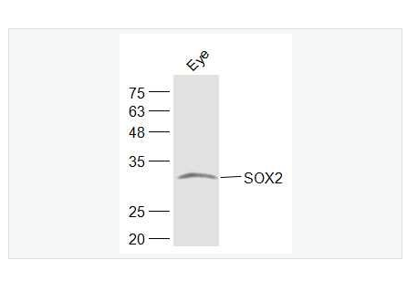 Anti-SOX2  antibody  -胚胎干细胞关键蛋白抗体