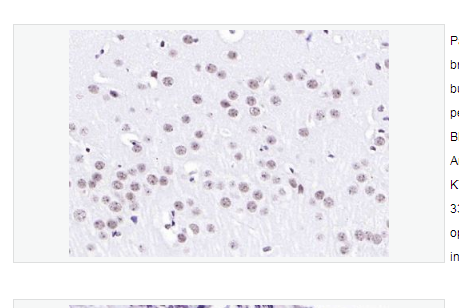 Anti-Histone H3 antibody  -甲基化组蛋白H3(mono methyl K79)单克隆抗体