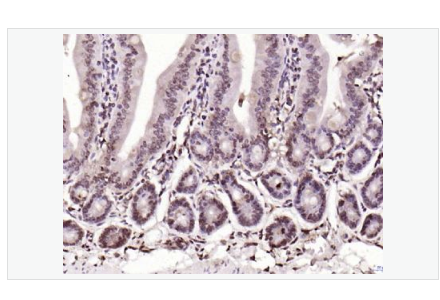 Anti-BLM antibody  -Bloom综合征相关蛋白抗体