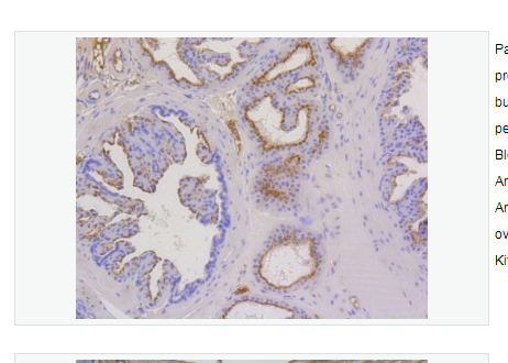 Anti-Cytokeratin 17 antibody  -细胞角蛋白17重组兔单克隆抗体