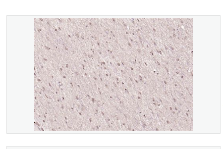 Anti-HMGB1  antibody  -高迁移率族蛋白B1抗体