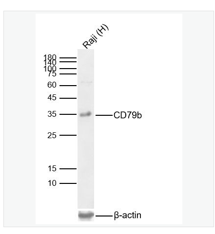 Anti-CD79b antibody  -CD79b重组兔单克隆抗体