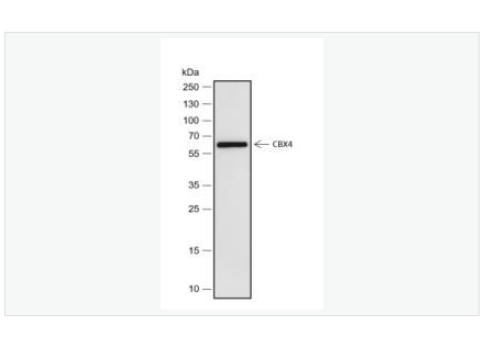 Anti-CBX4 antibody  -染色盒同源物4重组兔单克隆抗体