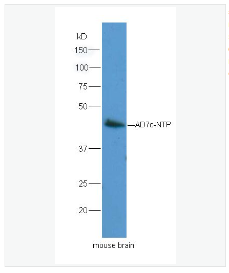 Anti-Neuronal thread protein AD7c-NTP  antibody  -神经丝蛋白抗体