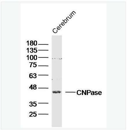 Anti-CNPase antibody  -2’,3’-环腺苷酸-3’-磷酸二酯酶抗体