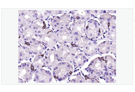 Anti-CHGA antibody  -嗜铬粒素A抗体
