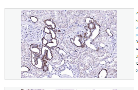  Anti-EMP-1antibody  -表皮膜蛋白1抗体