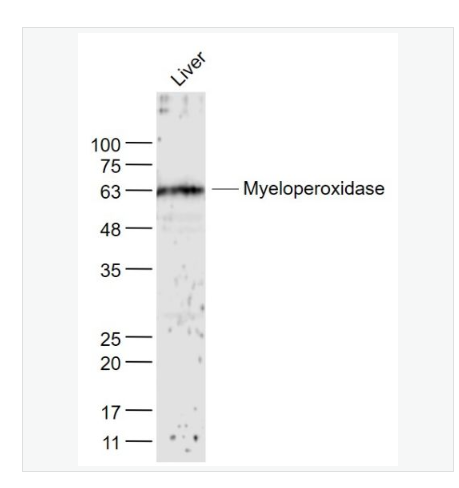 Anti-MPO antibody  -髓过氧化物酶抗体