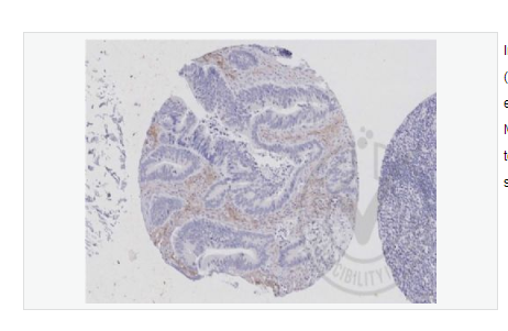 Anti-MEK2 antibody  -丝裂原活化蛋白激酶激酶2抗体