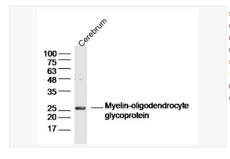Anti-MOG antibody  -髓鞘少树突胶质细胞糖蛋白抗体