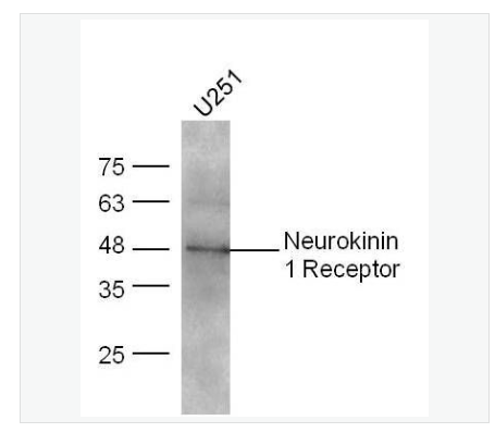 Anti-Neurokinin 1 Receptorantibody  -P物质受体抗体