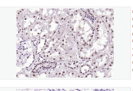 Anti-WWOX antibody  -包含氧化还原酶的WW域抗体