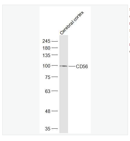 Anti-CD56  antibody  -神经细胞粘附分子1抗体