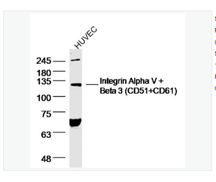 Anti-Integrin Alpha V + Beta 3 antibody  -整合素αVβ3抗体