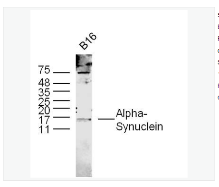 Anti-Alpha-Synuclein antibody  -核突触蛋白α抗体