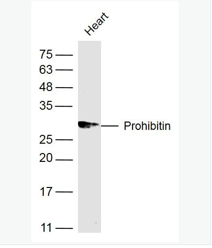 Anti-Prohibitin  antibody  -阻抑素/肿瘤抑制因子抗体