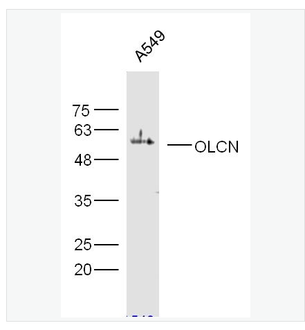 Anti-OCLN antibody  -紧密连接蛋白抗体