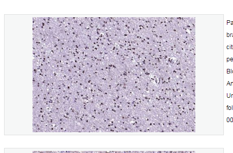 Anti-S100B antibody  -S100B蛋白抗体