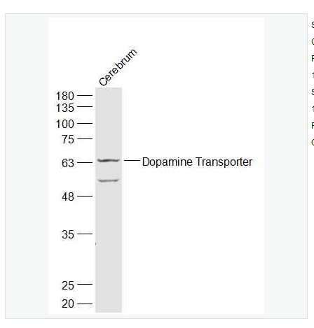 Anti-Dopamine Transporter antibody  -多巴胺转运蛋白DAT抗体