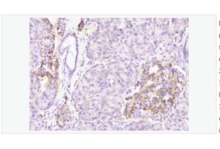 Anti-Phospho-Bcl-2antibody  -磷酸化Bcl-2抗体