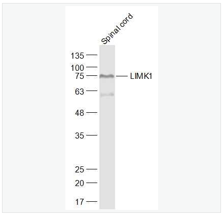 Anti-LIMK1  antibody  -单丝氨酸蛋白激酶1抗体