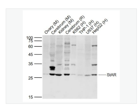 Anti-StAR antibody  -促黄体激素诱导蛋白抗体
