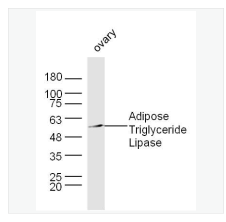 Anti-Adipose Triglyceride Lipase antibody  -脂肪甘油三酯脂酶抗体