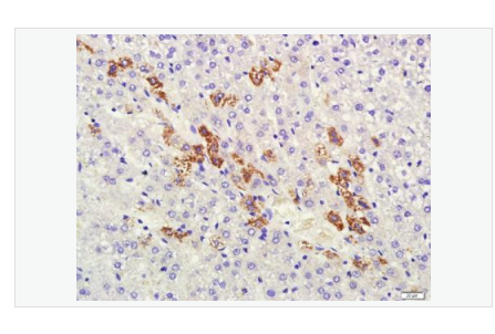 Anti-HSD3B1 antibody  -滋养层细胞抗原3β-HSD抗体