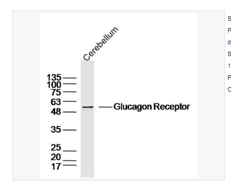 Anti-Glucagon Receptor  antibody  -胰高血糖素受体抗体