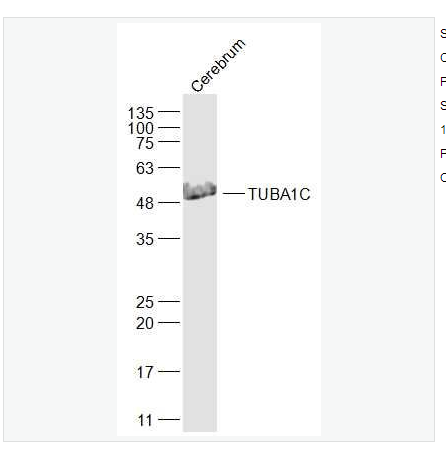 Anti-TUBA1C antibody  -微管相关蛋白α6抗体