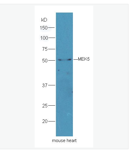Anti-MEK5  antibody  -丝裂原活化蛋白激酶激酶5抗体