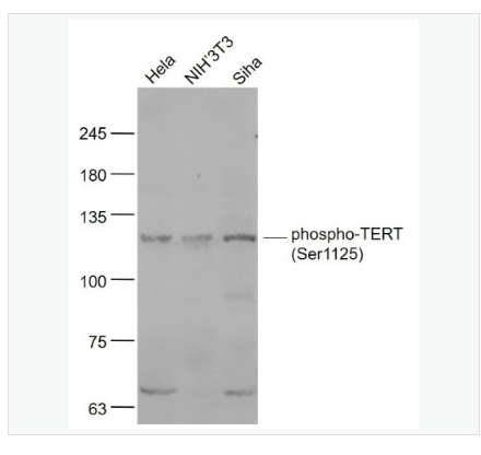 Anti-phospho-TERT  antibody  -磷酸化端粒酶逆转录酶抗体