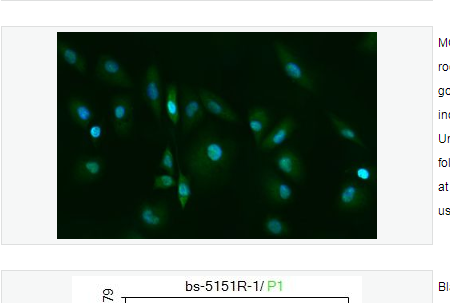 Anti-Acrosin antibody-精子顶体前体蛋白抗体
