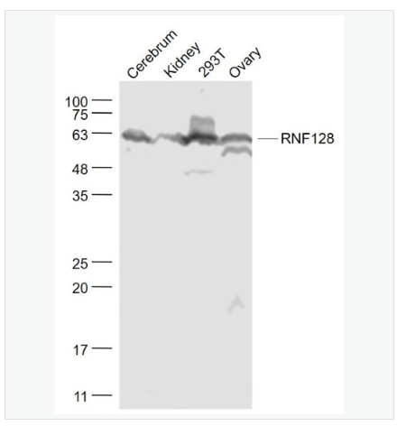 Anti-RNF128 antibody-环指蛋白128抗体