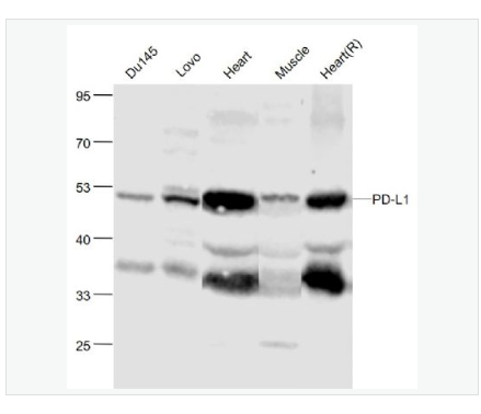 Anti-PD-L1antibody-程序性死亡配体1（CD274）抗体