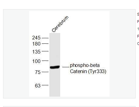 Anti-phospho-beta Catenin  antibody-磷酸化β-连环蛋白/β-连环素/β链接素抗体