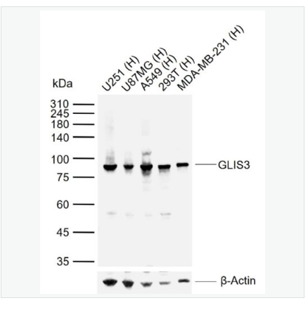 Anti-GLIS3 antibody-锌指蛋白ZNF515抗体