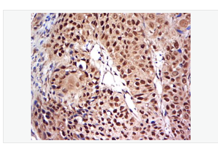Anti-NFKB p65  antibody-细胞核因子/k基因结合核因子抗体