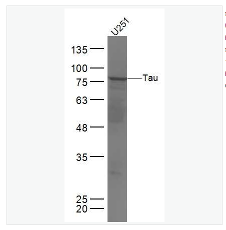 Anti-Tau  antibody-微管相关蛋白抗体