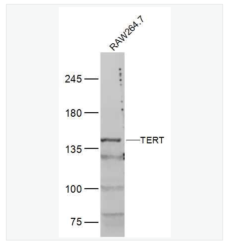 Anti-TERT  antibody-端粒酶逆转录酶抗体